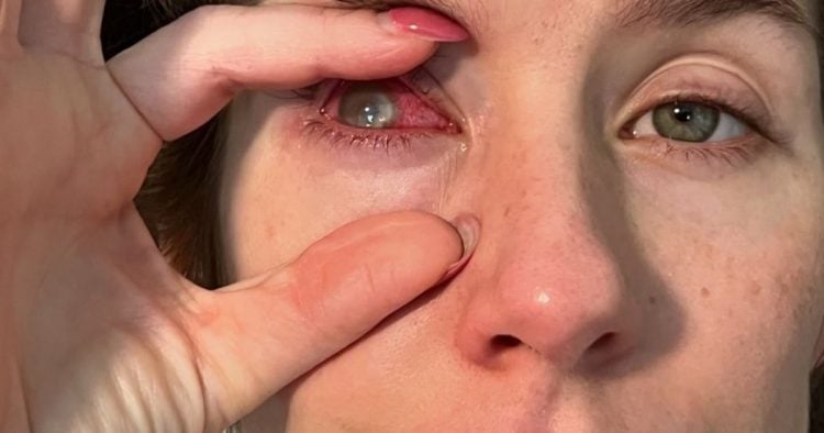 Une terrible infection