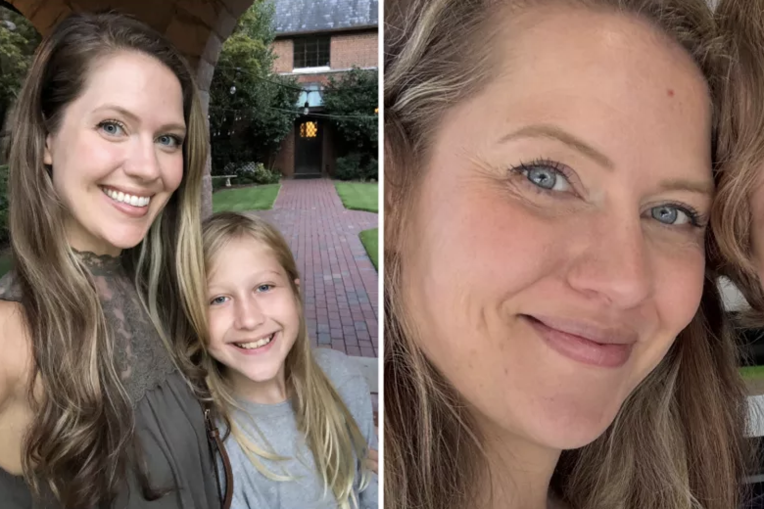 Cette femme de 33 ans qui pensait avoir un simple bouton d&eacute;couvre que c'est un cancer, "Fiez-vous &agrave; votre instinct"