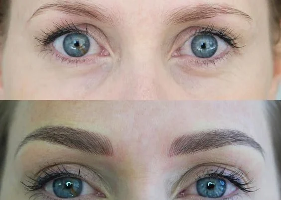 Avant-apres-des-petits-sourcils (2)