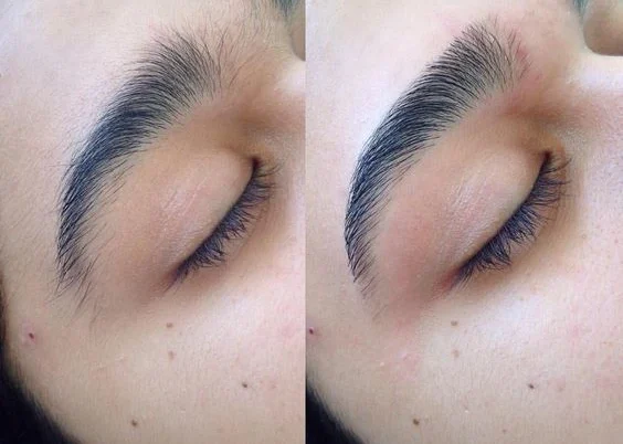 Avant-apres-des-sourcils-structures