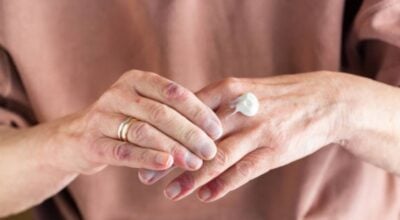 Plusieurs traitements permettent aujourd’hui de contrôler le psoriasis