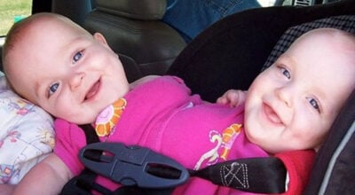 Macey et Mackenzie avant leur opération de séparation